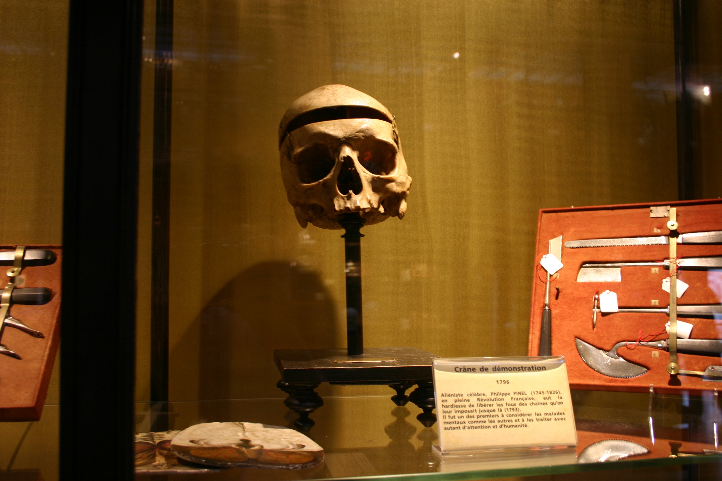 Philippe Pinel demonstration skull, Musée d'Histoire de la Médecine, Paris (44).JPG